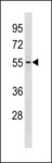 GTDC1 Antibody - GTDC1 Antibody western blot of Jurkat cell line lysates (35 ug/lane). The GTDC1 antibody detected the GTDC1 protein (arrow).