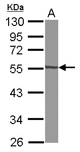 GTDC1 Antibody - Sample (30 ug of whole cell lysate) A: A549 10% SDS PAGE GTDC1 antibody diluted at 1:1000