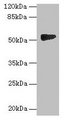 GTDC1 Antibody - Western blot All lanes: GTDC1 antibody at 4µg/ml + A549 whole cell lysate Secondary Goat polyclonal to rabbit IgG at 1/10000 dilution Predicted band size: 53, 44, 34, 50, 38 kDa Observed band size: 53 kDa