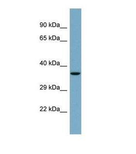 GTDC1 Antibody - Western blot of Human PANC1. GTDC1 antibody dilution 1.0 ug/ml.  This image was taken for the unconjugated form of this product. Other forms have not been tested.