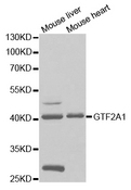 GTF2A1 / TFIIA Antibody - Western blot analysis of extracts of various cell lines.