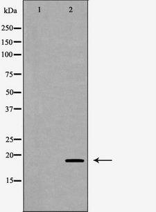 GTF2A1 / TFIIA Antibody - Western blot analysis of mouse liver tissue lysates using GTF2A1 antibody. The lane on the left is treated with the antigen-specific peptide.