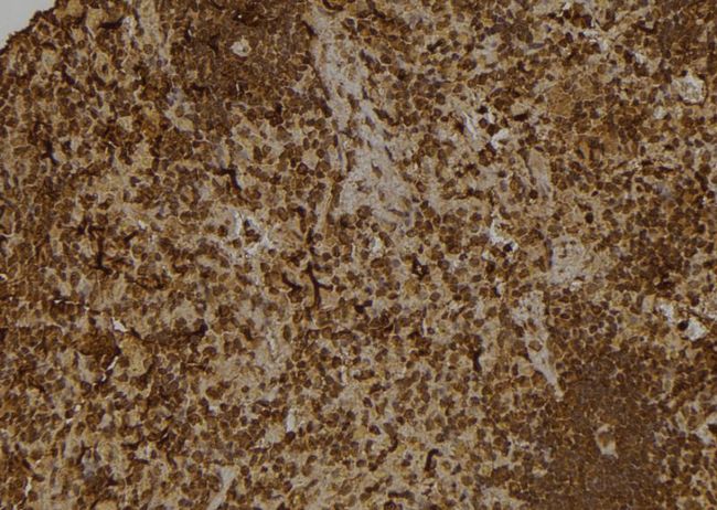 GTF2A1 / TFIIA Antibody - 1:100 staining rat spleen tissue by IHC-P. The sample was formaldehyde fixed and a heat mediated antigen retrieval step in citrate buffer was performed. The sample was then blocked and incubated with the antibody for 1.5 hours at 22°C. An HRP conjugated goat anti-rabbit antibody was used as the secondary.