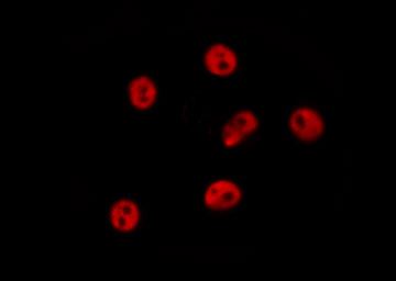 GTF2A1 / TFIIA Antibody - Staining RAW264.7 cells by IF/ICC. The samples were fixed with PFA and permeabilized in 0.1% Triton X-100, then blocked in 10% serum for 45 min at 25°C. The primary antibody was diluted at 1:200 and incubated with the sample for 1 hour at 37°C. An Alexa Fluor 594 conjugated goat anti-rabbit IgG (H+L) antibody, diluted at 1/600, was used as secondary antibody.