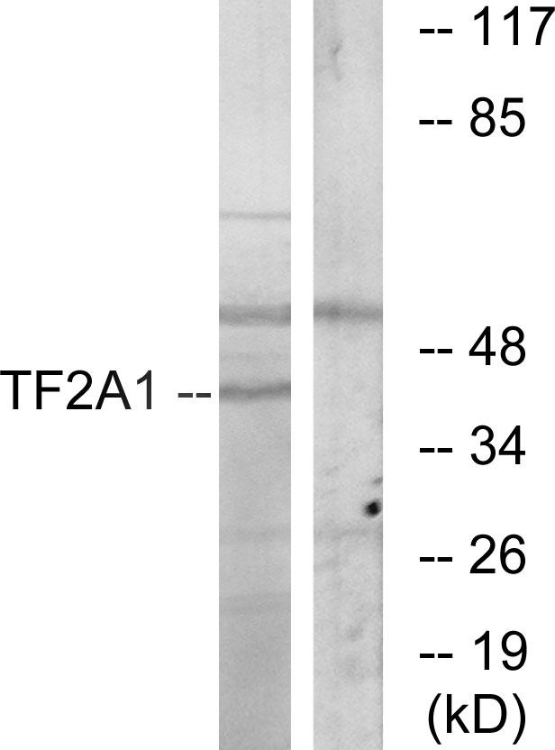 GTF2A1 / TFIIA Antibody - Western blot analysis of extracts from RAW264.7 cells, using TF2A1 antibody.