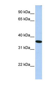 GTF2A1 / TFIIA Antibody - GTF2A1 antibody Western blot of HepG2 cell lysate. This image was taken for the unconjugated form of this product. Other forms have not been tested.