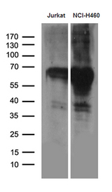 GTF2A1L / ALF Antibody - Western blot analysis of extracts. (35ug) from 2 different cell lines by using anti-GTF2A1L monoclonal antibody. (1:500)