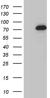 GTF2A1L / ALF Antibody - HEK293T cells were transfected with the pCMV6-ENTRY control. (Left lane) or pCMV6-ENTRY GTF2A1L. (Right lane) cDNA for 48 hrs and lysed. Equivalent amounts of cell lysates. (5 ug per lane) were separated by SDS-PAGE and immunoblotted with anti-GTF2A1L. (1:2000)