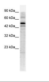 GTF2A1L / ALF Antibody - Jurkat Cell Lysate.  This image was taken for the unconjugated form of this product. Other forms have not been tested.