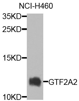 GTF2A2 / TFIIA Antibody - Western blot analysis of extracts of NCl-H460 cells.