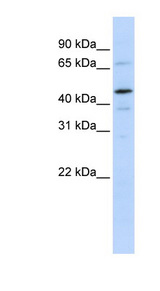 GTF2E1 Antibody - GTF2E1 antibody Western blot of 721_B cell lysate. This image was taken for the unconjugated form of this product. Other forms have not been tested.
