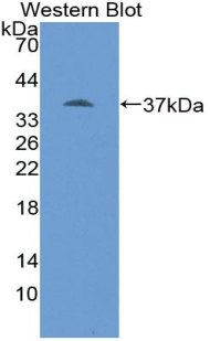 GTF2E1 Antibody - Western blot of GTF2E1 antibody.