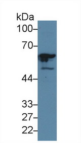 GTF2E1 Antibody - Western Blot; Sample: Human Hela cell lysate; Primary Ab: 5µg/ml Rabbit Anti-Human GTF2E1 Antibody Second Ab: 0.2µg/mL HRP-Linked Caprine Anti-Rabbit IgG Polyclonal Antibody