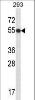 GTF2E1 Antibody - GTF2E1 Antibody western blot of 293 cell line lysates (35 ug/lane). The GTF2E1 antibody detected the GTF2E1 protein (arrow).