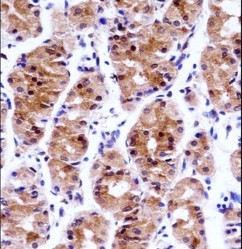 GTF2E1 Antibody - GTF2E1 Antibody immunohistochemistry of formalin-fixed and paraffin-embedded human stomach tissue followed by peroxidase-conjugated secondary antibody and DAB staining.
