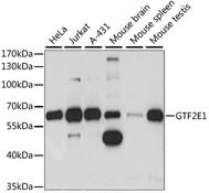 GTF2E1 Antibody - Western blot analysis of extracts of various cell lines, using GTF2E1 antibody at 1:1000 dilution. The secondary antibody used was an HRP Goat Anti-Rabbit IgG (H+L) at 1:10000 dilution. Lysates were loaded 25ug per lane and 3% nonfat dry milk in TBST was used for blocking. An ECL Kit was used for detection and the exposure time was 5S.