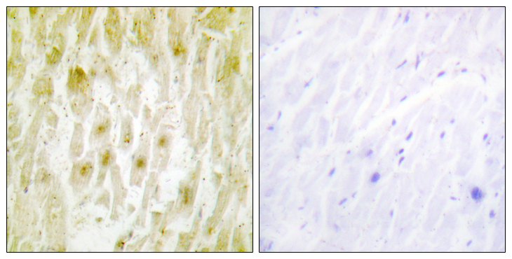 GTF2E2 Antibody - Immunohistochemistry analysis of paraffin-embedded human heart tissue, using TF2E2 Antibody. The picture on the right is blocked with the synthesized peptide.