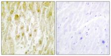 GTF2E2 Antibody - Immunohistochemistry analysis of paraffin-embedded human heart tissue, using TF2E2 Antibody. The picture on the right is blocked with the synthesized peptide.