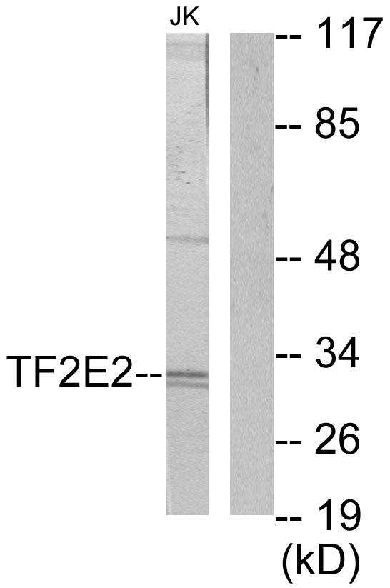 GTF2E2 Antibody - Western blot analysis of lysates from Jurkat cells, using TF2E2 Antibody. The lane on the right is blocked with the synthesized peptide.