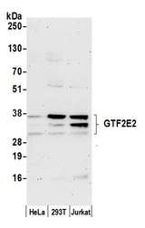 GTF2E2 Antibody - Detection of human GTF2E2 by western blot. Samples: Whole cell lysate (50 µg) from HeLa, HEK293T, and Jurkat cells prepared using NETN lysis buffer. Antibody: Affinity purified rabbit anti-GTF2E2 antibody used for WB at 0.1 µg/ml. Detection: Chemiluminescence with an exposure time of 3 minutes.