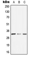 GTF2E2 Antibody - Western blot analysis of GTF2E2 expression in HeLa (A); SP2/0 (B); H9C2 (C) whole cell lysates.