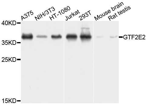 GTF2E2 Antibody - Western blot analysis of extracts of various cells.