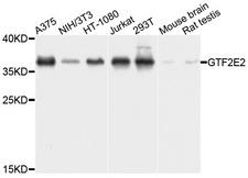 GTF2E2 Antibody - Western blot analysis of extracts of various cells.