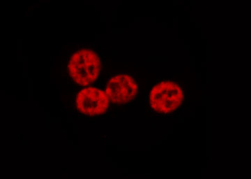 GTF2E2 Antibody - Staining HeLa cells by IF/ICC. The samples were fixed with PFA and permeabilized in 0.1% Triton X-100, then blocked in 10% serum for 45 min at 25°C. The primary antibody was diluted at 1:200 and incubated with the sample for 1 hour at 37°C. An Alexa Fluor 594 conjugated goat anti-rabbit IgG (H+L) antibody, diluted at 1/600, was used as secondary antibody.