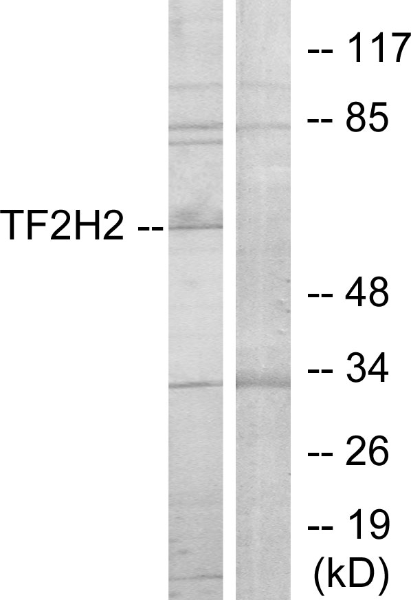 GTF2H2 Antibody - Western blot analysis of lysates from COLO205 cells, using TF2H2 Antibody. The lane on the right is blocked with the synthesized peptide.