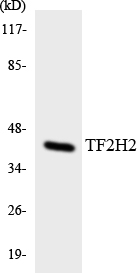 GTF2H2 Antibody - Western blot analysis of the lysates from COLO205 cells using TF2H2 antibody.