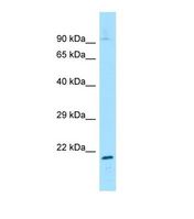 GTF2H2 Antibody - Western blot of Mouse Muscle. Gtf2h2 antibody dilution 1.0 ug/ml.  This image was taken for the unconjugated form of this product. Other forms have not been tested.