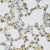 GTF2H2 Antibody - Immunohistochemistry of paraffin-embedded rat lung tissue.