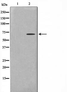 GTF2H2 Antibody - Western blot analysis on COLO205 cell lysates using TF2H2 antibody. The lane on the left is treated with the antigen-specific peptide.