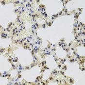 GTF2H2 Antibody - Immunohistochemistry of paraffin-embedded Rat lung using GTF2H2 Polyclonal Antibody at dilution of 1:100 (40x lens).