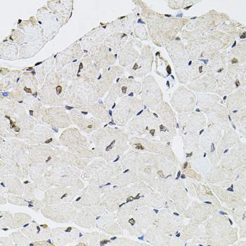 GTF2H2 Antibody - Immunohistochemistry of paraffin-embedded Mouse heart using GTF2H2 Polyclonal Antibody at dilution of 1:100 (40x lens).