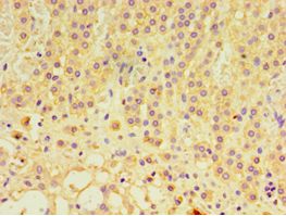 GTF2H2C Antibody - Immunohistochemistry of paraffin-embedded human adrenal gland using antibody at 1:100 dilution.