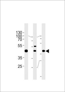 GTF2H2C Antibody - GTF2H2C Antibody western blot of A549,K562,MCF-7 cell line lysates (35 ug/lane). The GTF2H2C antibody detected the GTF2H2C protein (arrow).