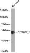 GTF2H2C Antibody - Western blot analysis of extracts of rat brain using GTF2H2C_2 Polyclonal Antibody at dilution of 1:1000.
