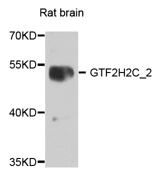 GTF2H2C_2 / GTF2H2D Antibody - Western blot analysis of extract of various cells.