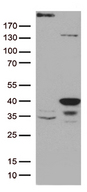 GTF2H3 Antibody - HEK293T cells were transfected with the pCMV6-ENTRY control. (Left lane) or pCMV6-ENTRY GTF2H3. (Right lane) cDNA for 48 hrs and lysed