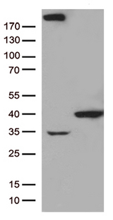 GTF2H3 Antibody - HEK293T cells were transfected with the pCMV6-ENTRY control. (Left lane) or pCMV6-ENTRY GTF2H3. (Right lane) cDNA for 48 hrs and lysed. Equivalent amounts of cell lysates. (5 ug per lane) were separated by SDS-PAGE and immunoblotted with anti-GTF2H3. (1:500)