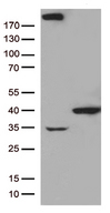 GTF2H3 Antibody - HEK293T cells were transfected with the pCMV6-ENTRY control. (Left lane) or pCMV6-ENTRY GTF2H3. (Right lane) cDNA for 48 hrs and lysed. Equivalent amounts of cell lysates. (5 ug per lane) were separated by SDS-PAGE and immunoblotted with anti-GTF2H3. (1:500)