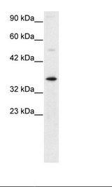 GTF2H3 Antibody - Jurkat Cell Lysate.  This image was taken for the unconjugated form of this product. Other forms have not been tested.