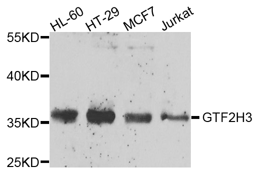 GTF2H3 Antibody - Western blot analysis of extracts of various cells.