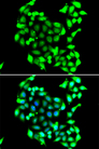 GTF2H3 Antibody - Immunofluorescence analysis of A549 cells.