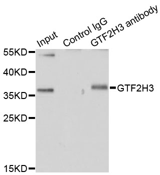 GTF2H3 Antibody - Immunoprecipitation analysis of 200ug extracts of HT-29 cells.