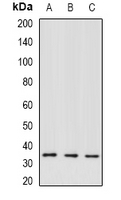 GTF2H3 Antibody - Western blot analysis of TFIIH p34 expression in HT29 (A); MCF7 (B); Jurkat (C) whole cell lysates.