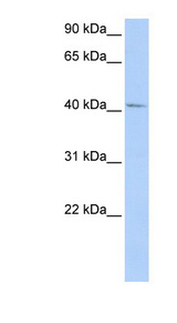 GTF2H4 / TFB2 Antibody - GTF2H4 antibody Western blot of HepG2 cell lysate. This image was taken for the unconjugated form of this product. Other forms have not been tested.
