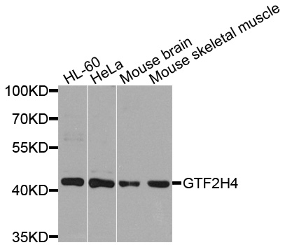 GTF2H4 / TFB2 Antibody - Western blot analysis of extracts of various cells.