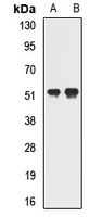 GTF2H4 / TFB2 Antibody